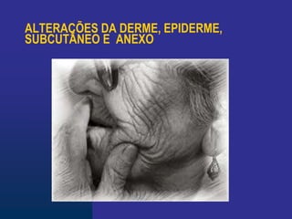 ALTERAÇÕES DA DERME, EPIDERME,
SUBCUTÂNEO E ANEXO
 