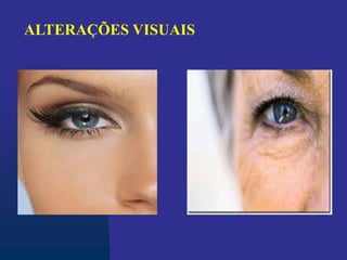 ALTERAÇÕES VISUAIS
 