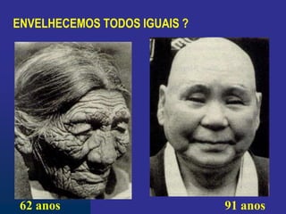 ENVELHECEMOS TODOS IGUAIS ?
62 anos 91 anos
 