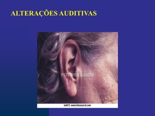 ALTERAÇÕES AUDITIVAS
 