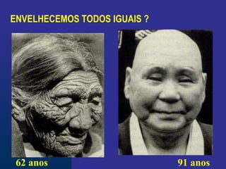 ENVELHECEMOS TODOS IGUAIS ?
62 anos 91 anos
 