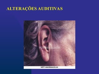 ALTERAÇÕES AUDITIVAS
 