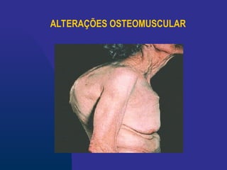 ALTERAÇÕES OSTEOMUSCULAR
 