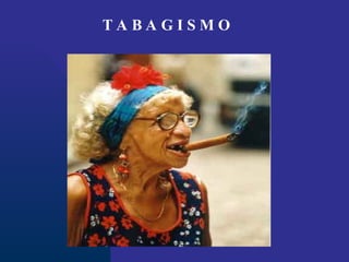 T A B A G I S M O
 