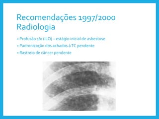 Recomendações 1997/2000
Radiologia
• Profusão 1/0 (ILO) – estágio inicial de asbestose
• Padronização dos achados àTC pendente
• Rastreio de câncer pendente
 