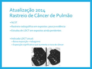 Atualização 2014
Rastreio de Câncer de Pulmão
• NLST
• Rastreio radiográfico em expostos: pouca evidência
• Estudos de LDCT em expostos ainda pendentes
• Indicada LDCT anual:
• Baixa exposição + tabagismo
• Exposição significativa que aumenta o risco de câncer
 