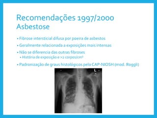 Recomendações 1997/2000
Asbestose
• Fibrose intersticial difusa por poeira de asbestos
• Geralmente relacionada a exposições mais intensas
• Não se diferencia das outras fibroses
• História de exposição e >2 corpos/cm²
• Padronização de graus histológicos pelo CAP-NIOSH (mod. Roggli)
 