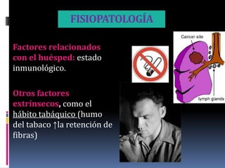 FISIOPATOLOGÍA

Factores relacionados
con el huésped: estado
inmunológico.

Otros factores
extrínsecos, como el
hábito tabáquico (humo
del tabaco ↑la retención de
fibras)
 
