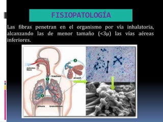 FISIOPATOLOGÍA
Las fibras penetran en el organismo por vía inhalatoria,
alcanzando las de menor tamaño (<3μ) las vías aéreas
inferiores.
 
