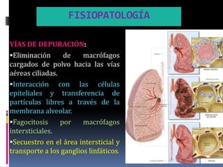 FISIOPATOLOGÍA

VÍAS DE DEPURACIÓN:
Eliminación      de    macrófagos
cargados de polvo hacia las vías
aéreas ciliadas.
Interacción con las células
epiteliales y transferencia de
partículas libres a través de la
membrana alveolar.
Fagocitosis     por    macrófagos
intersticiales.
Secuestro en el área intersticial y
transporte a los ganglios linfáticos.
 