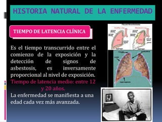 HISTORIA NATURAL DE LA ENFERMEDAD

 TIEMPO DE LATENCIA CLÍNICA


Es el tiempo transcurrido entre el
comienzo de la exposición y la
detección     de       signos     de
asbestosis,    es      inversamente
proporcional al nivel de exposición.
Tiempo de latencia medio: entre 12
            y 20 años.
La enfermedad se manifiesta a una
edad cada vez más avanzada.
 