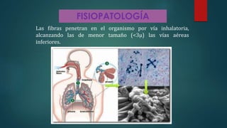 FISIOPATOLOGÍA
Las fibras penetran en el organismo por vía inhalatoria,
alcanzando las de menor tamaño (<3μ) las vías aéreas
inferiores.
 
