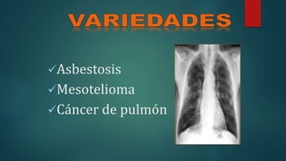 Asbestosis
Mesotelioma
Cáncer de pulmón
 