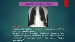 MANIFESTACIONES
CLÍNICAS
Radiografía:
• Opacidades irregulares pequeñas predominantes en los 2/3 inf
de los campos pulmonares.
•Ocasionalmente opacidades redondeadas pequeñas, con
engrosamiento pleural, circunscrito o difuso con calcificaciones,
reduciendo la capacidad vital y los famosos “dedos
hipocráticos”
 