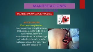MANIFESTACIONES
CLINICAS
MANIFESTACIONES PULMONARES
AUSCULTACIÓN
Estertores crepitantes.
Luego aparecen complicaciones
bronquiales, sobre todo en los
fumadores, así como
manifestaciones de sobrecarga
del lado derecho del corazón.
La frecuencia de fibrosis ↑ por
el habito tabáquico.
 