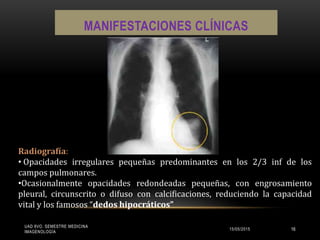 MANIFESTACIONES CLÍNICAS
Radiografía:
• Opacidades irregulares pequeñas predominantes en los 2/3 inf de los
campos pulmonares.
•Ocasionalmente opacidades redondeadas pequeñas, con engrosamiento
pleural, circunscrito o difuso con calcificaciones, reduciendo la capacidad
vital y los famosos “dedos hipocráticos”
UAD 8VO. SEMESTRE MEDICINA
IMAGENOLOGÍA
15/05/2015 16
 