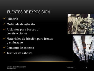  Minería
 Molienda de asbesto
 Aislantes para barcos o
construcciones
 Materiales de fricción para frenos
y embrague
 Cemento de asbesto
 Textiles de asbesto
FUENTES DE EXPOSICION
UAD 8VO. SEMESTRE MEDICINA
IMAGENOLOGÍA
15/05/2015 4
 