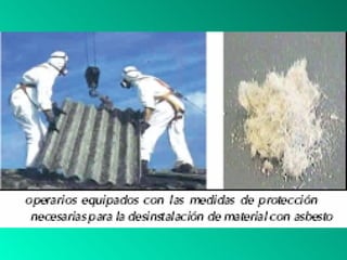 Asbestosis y Pulmon del Carbón