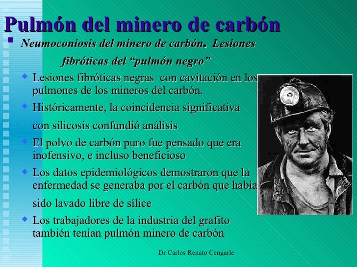 Asbestosis y Pulmon del Carbón