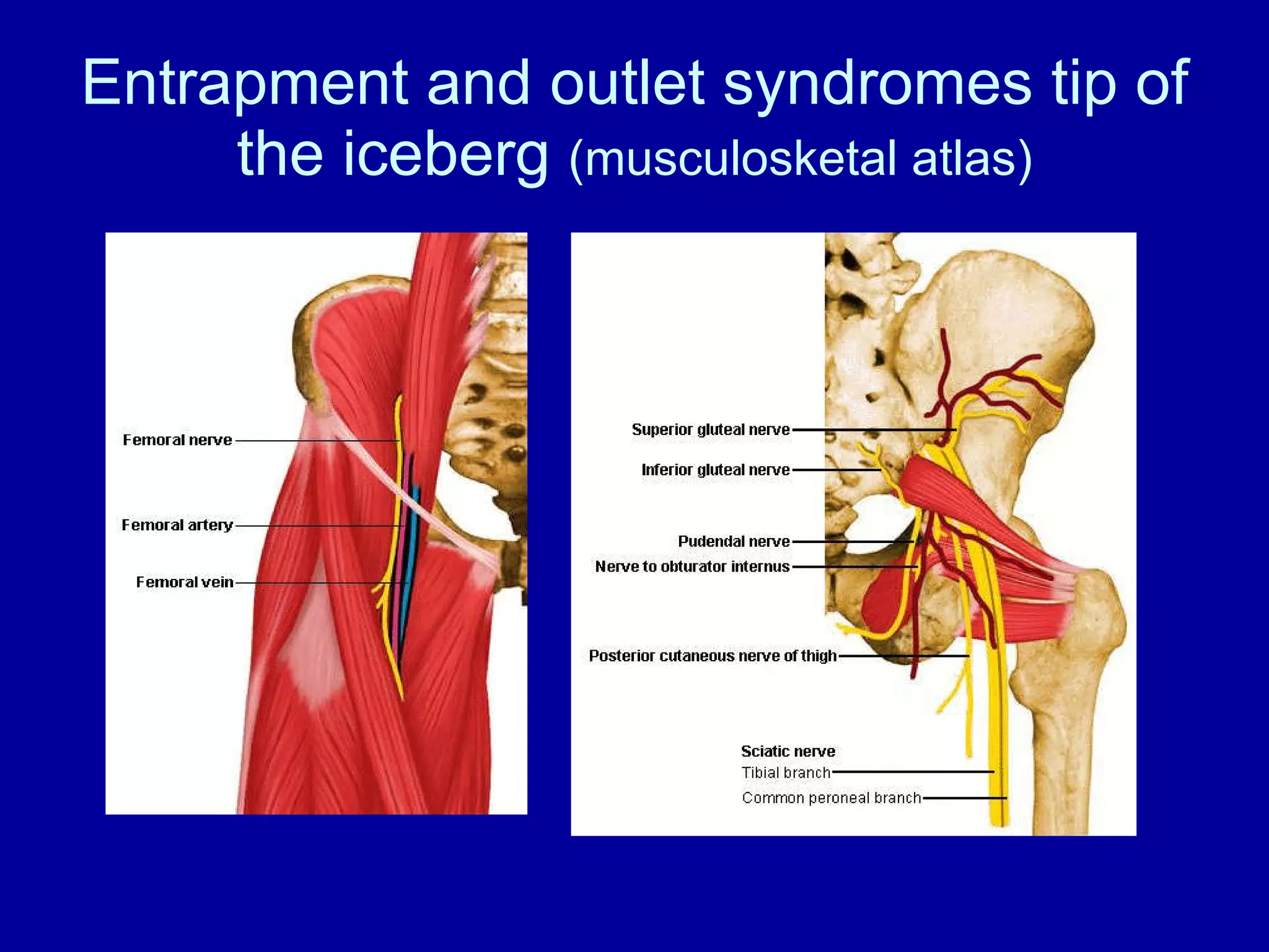 Entrapment and outlet syndromes tip of the iceberg  (musculosketal atlas) 