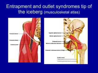 Entrapment and outlet syndromes tip of the iceberg  (musculosketal atlas) 