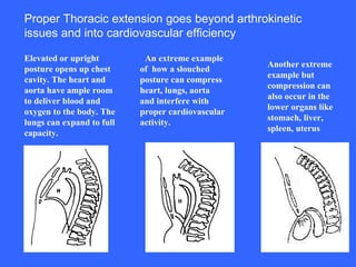 Elevated or upright posture opens up chest cavity. The heart and aorta have ample room to deliver blood and oxygen to the body. The lungs can expand to full capacity.   An extreme example of  how a slouched posture can compress heart, lungs, aorta and interfere with proper cardiovascular activity.    Another extreme example but compression can also occur in the lower organs like stomach, liver, spleen, uterus   Proper Thoracic extension goes beyond arthrokinetic issues and into cardiovascular efficiency  