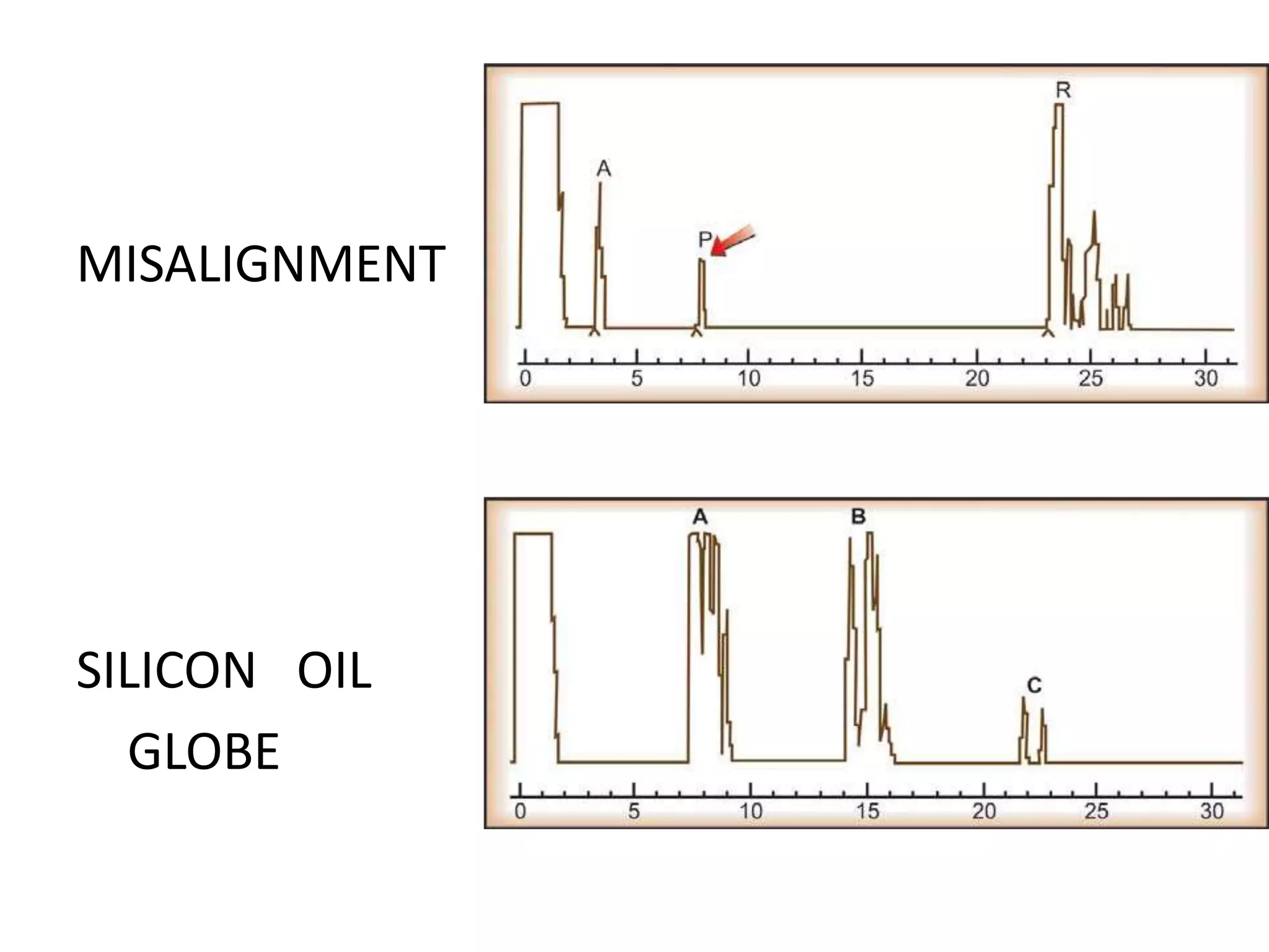 A scan ultrasonography | PPTX