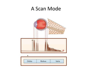A Scan Mode
 