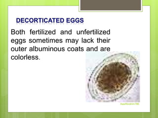 Both fertilized and unfertilized
eggs sometimes may lack their
outer albuminous coats and are
colorless.
Aasifibrahim786
 