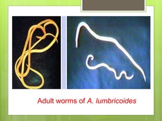 Adult worms of A. lumbricoides
Aasifibrahim786
 