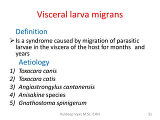 Ascariasis