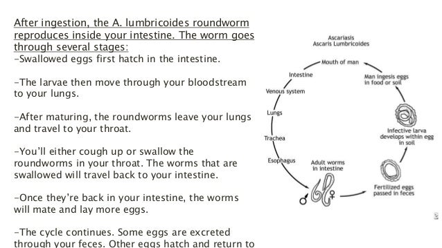 ascariasis roundworms