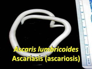 PARASITOLOGÍA MÉDICA
Ascariasis (ascariosis)
Ascaris lumbricoides
Ascariasis (ascariosis)
 
