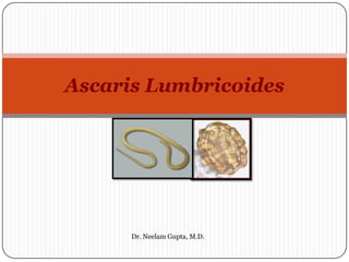 Ascaris Lumbricoides
Dr. Neelam Gupta, M.D.
 