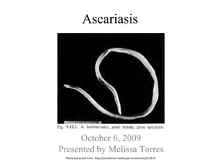 Ascariasis October 6, 2009 Presented by Melissa Torres Photo extracted from:  http://emedicine.medscape.com/article/212510 