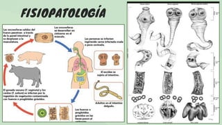 FISIOPATOLOGÍA
 