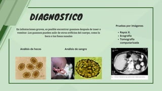 DIAGNOSTICO
En infestaciones graves, es posible encontrar gusanos después de toser o
vomitar. Los gusanos pueden salir de otros orificios del cuerpo, como la
boca o las fosas nasales
Análisis de heces Análisis de sangre
Pruebas por imágenes
Rayos X.
Ecografía
Tomografia
computarizada
 