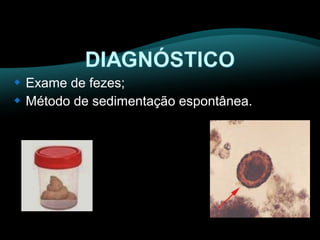  Exame de fezes; 
 Método de sedimentação espontânea. 
 