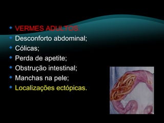 VERMES ADULTOS: 
 Desconforto abdominal; 
 Cólicas; 
 Perda de apetite; 
 Obstrução intestinal; 
 Manchas na pele; 
 Localizações ectópicas. 
 