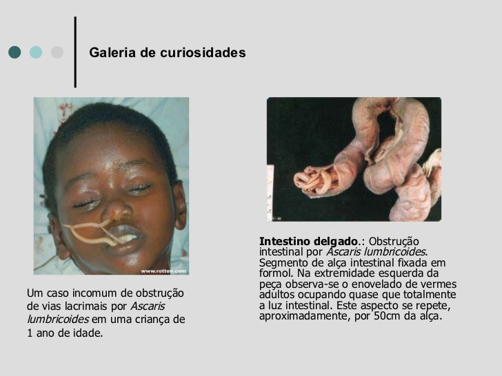 Pessoa de parasitas de uma foto