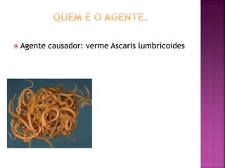  Agente causador: verme Ascaris lumbricoides 
 