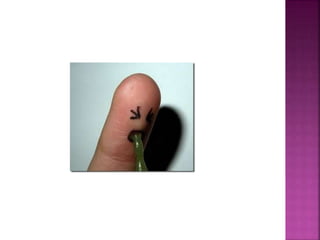 Ascaridíase sabrina ellen