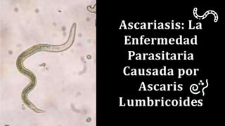 Ascariasis: La
Enfermedad
Parasitaria
Causada por
Ascaris
Lumbricoides
 