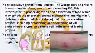ASCARIS-PATHOGENESIS AND CLINICAL FEATURE.pptx