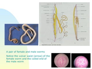 A pair of female and male worms  Notice the vulvar waist (arrow) of the female worm and the coiled end of the male worm 
