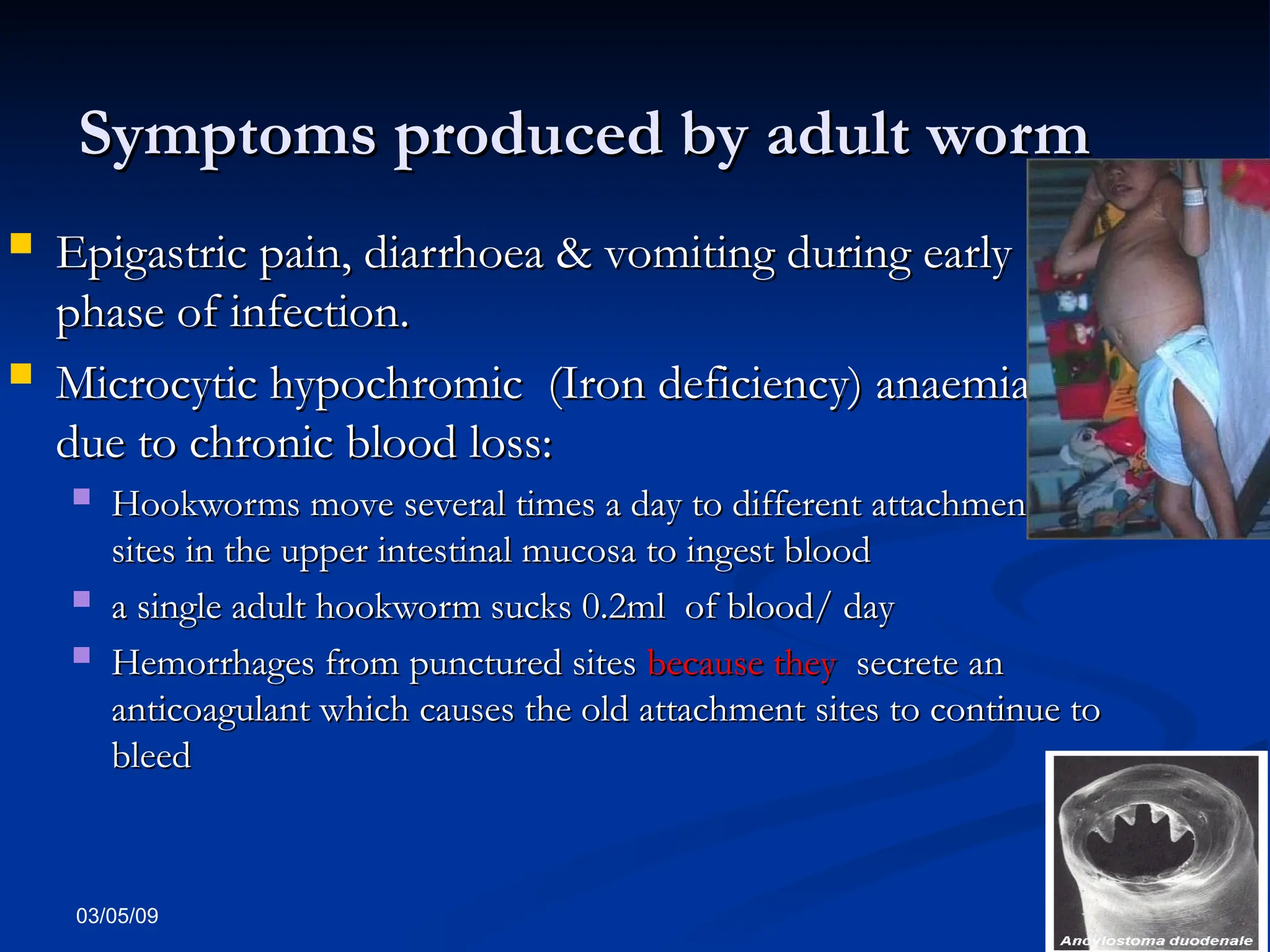 03/05/09
Symptoms produced by adult worm
Symptoms produced by adult worm
 Epigastric pain, diarrhoea & vomiting during early
Epigastric pain, diarrhoea & vomiting during early
phase of infection.
phase of infection.
 Microcytic hypochromic (Iron deficiency) anaemia –
Microcytic hypochromic (Iron deficiency) anaemia –
due to chronic blood loss:
due to chronic blood loss:
 Hookworms move several times a day to different attachment
Hookworms move several times a day to different attachment
sites in the upper intestinal mucosa to ingest blood
sites in the upper intestinal mucosa to ingest blood
 a single adult hookworm sucks 0.2ml of blood/ day
a single adult hookworm sucks 0.2ml of blood/ day
 Hemorrhages from punctured sites
Hemorrhages from punctured sites because they
because they secrete an
secrete an
anticoagulant which causes the old attachment sites to continue to
anticoagulant which causes the old attachment sites to continue to
bleed
bleed
 