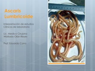 Ascaris
Lumbricoide
Interpretación de estudios
Clínicos de laboratorio

Lic. Medico Cirujano
Wbiliado Olán Reyes

Prof: Eduardo Cano
 
