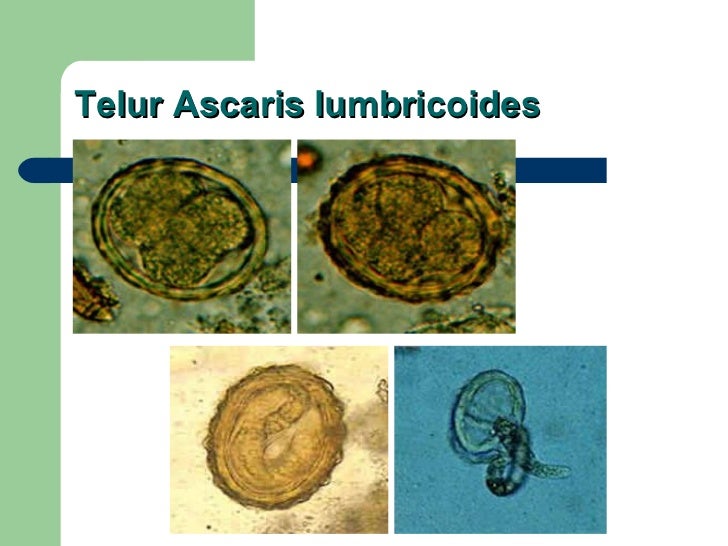 Ascaris Lumbricoides 10512175
