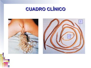 CUADRO CLÍNICO
 