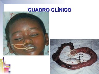 CUADRO CLÍNICO
 